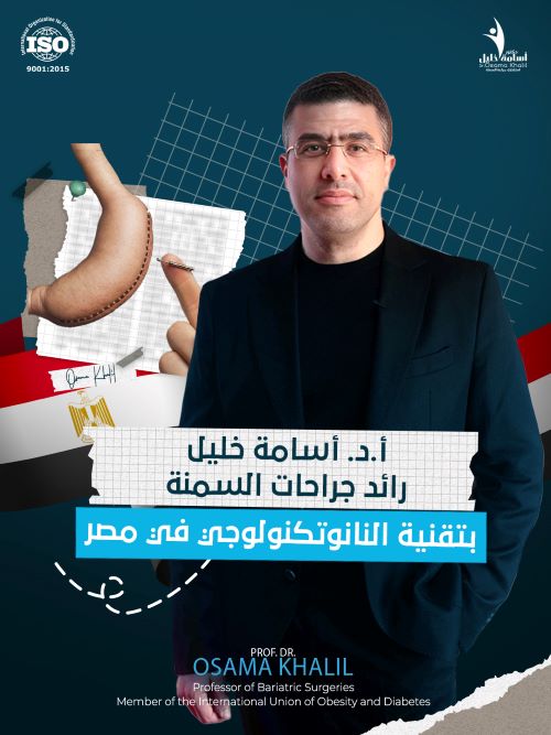 افضل دكتور بالون معدة في مصر